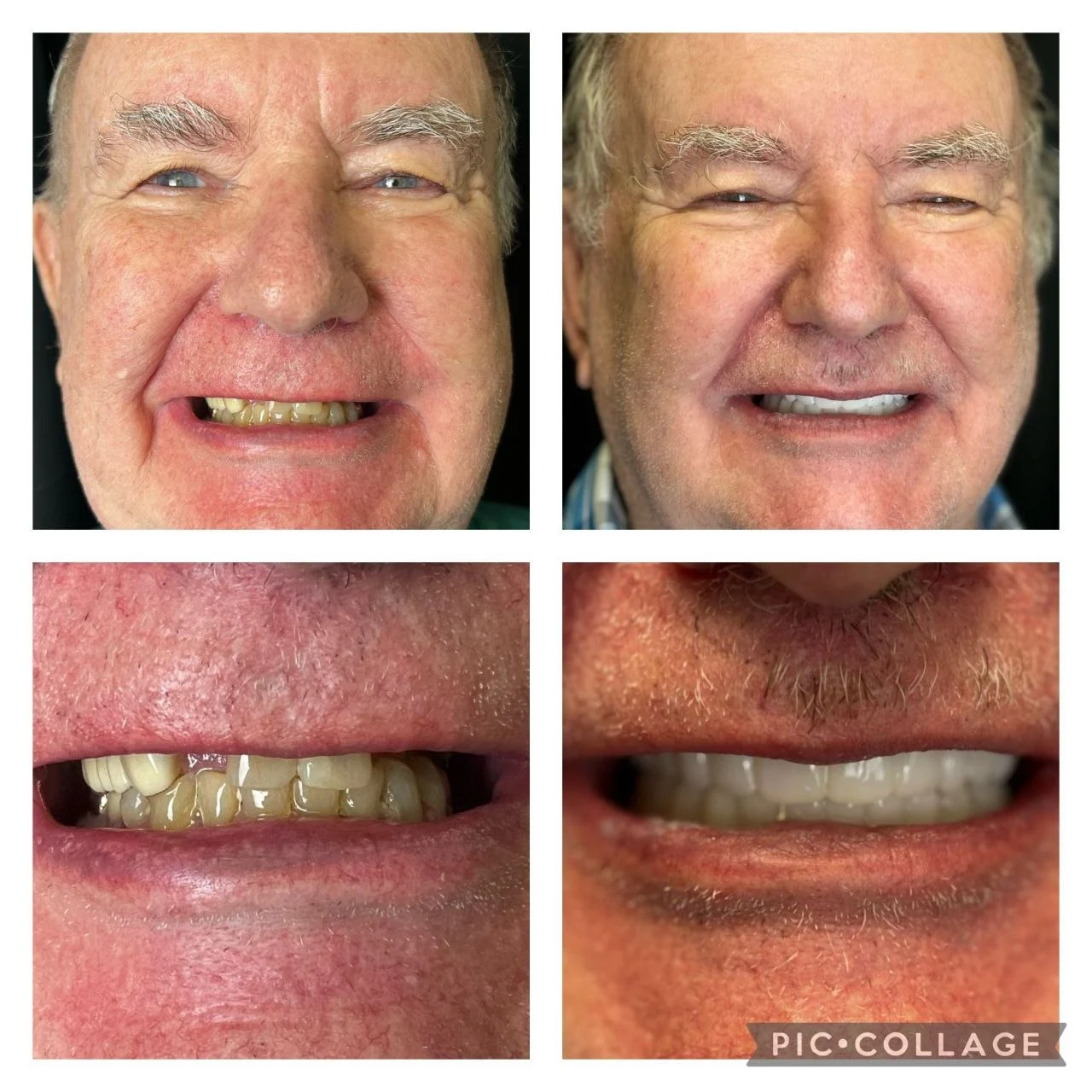 Smile transformation result 1