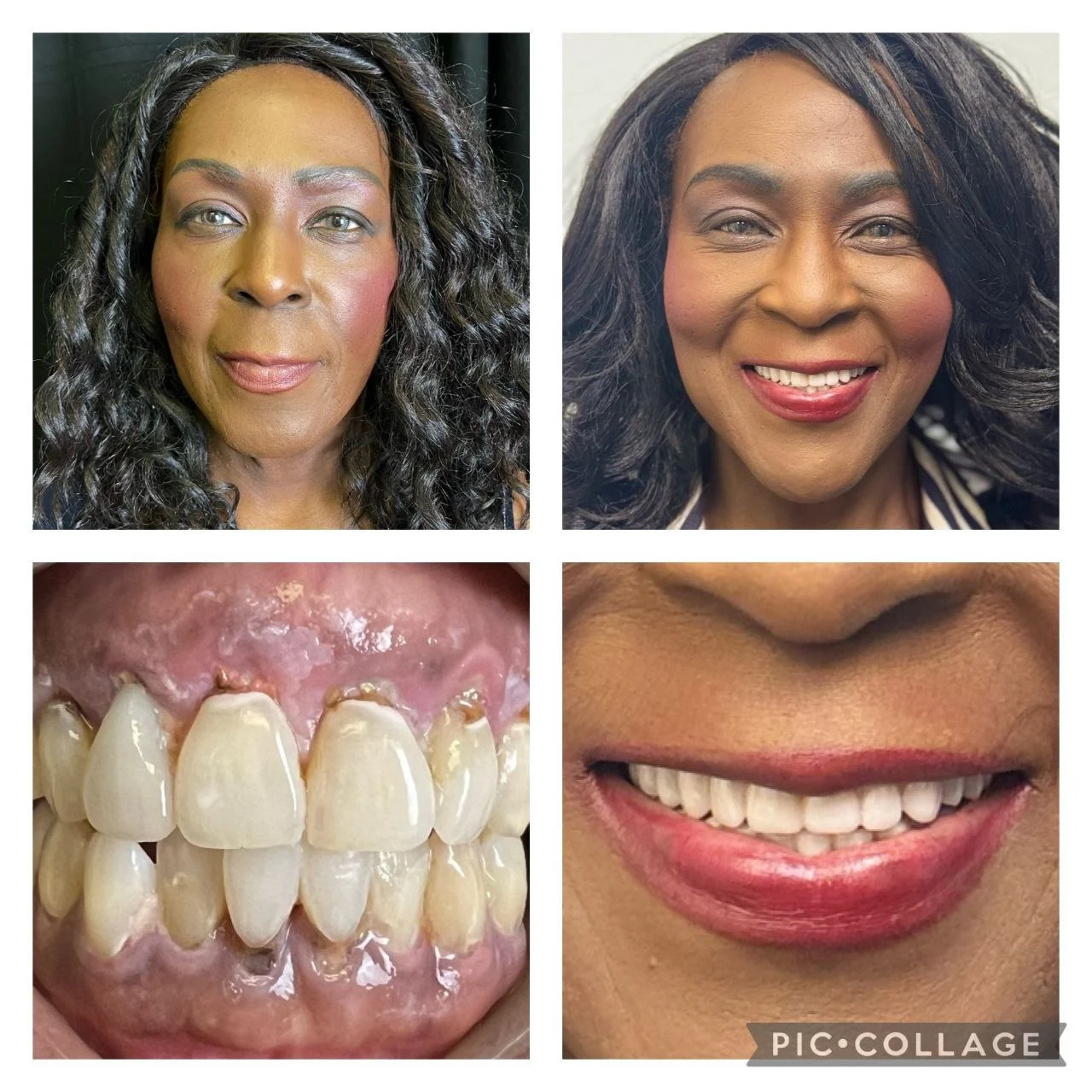 Smile transformation result 2