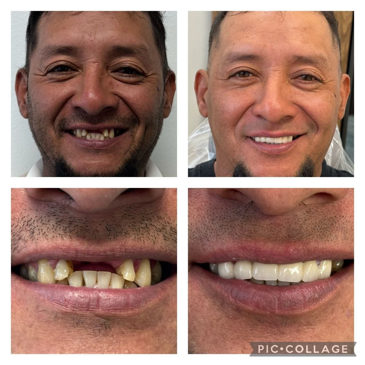 Smile transformation result 3