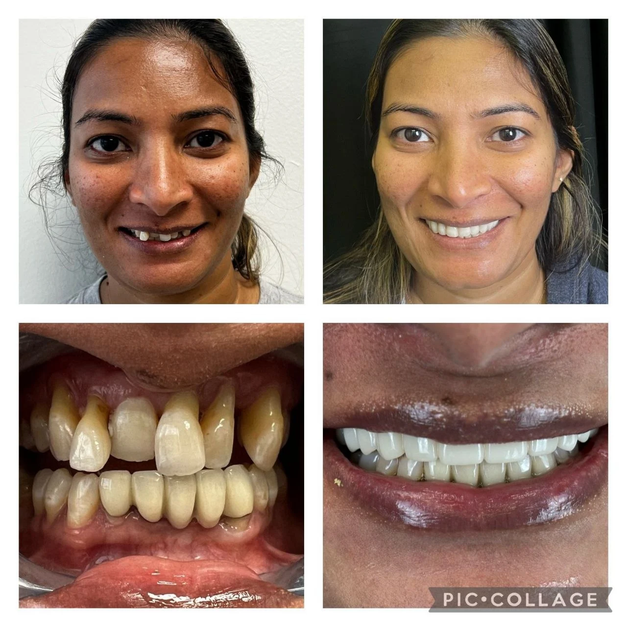 Smile transformation result 4