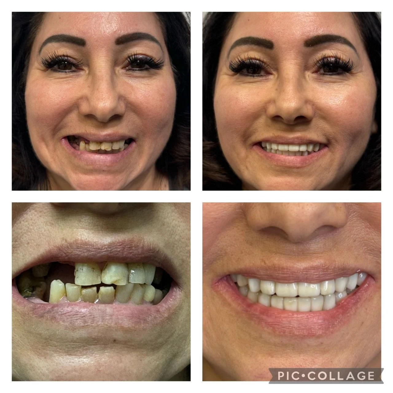 Smile transformation result 5
