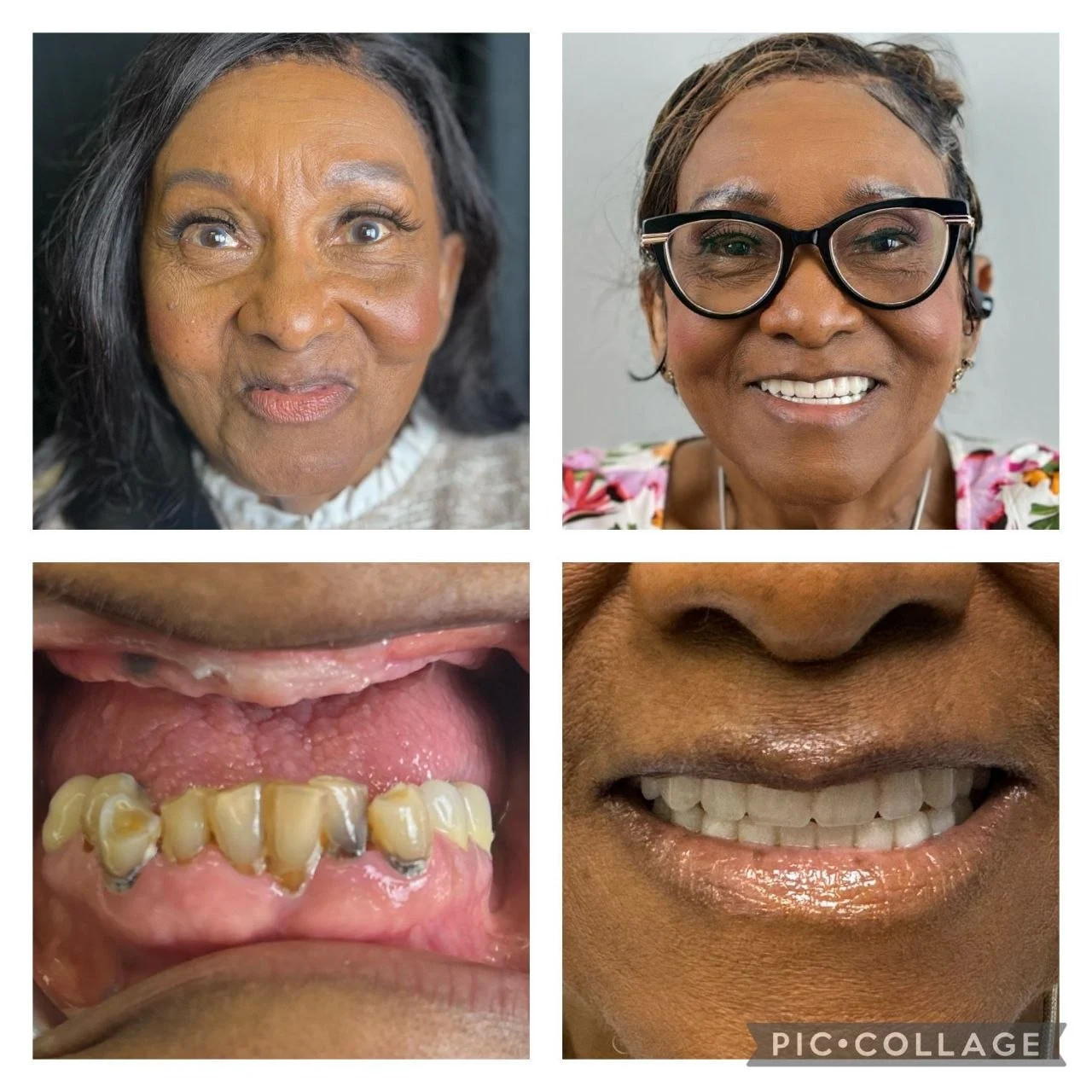 Smile transformation result 6