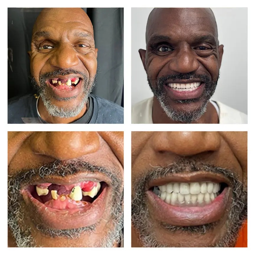 Smile transformation result 7